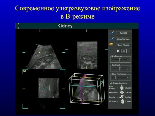 Современное ультразвуковое изображение в В-режиме