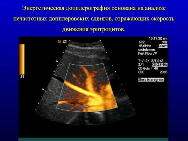 Энергетическая допплерография основана на анализе нечастотных допплеровских сдвигов, отражающих скорость движения эритроцитов.