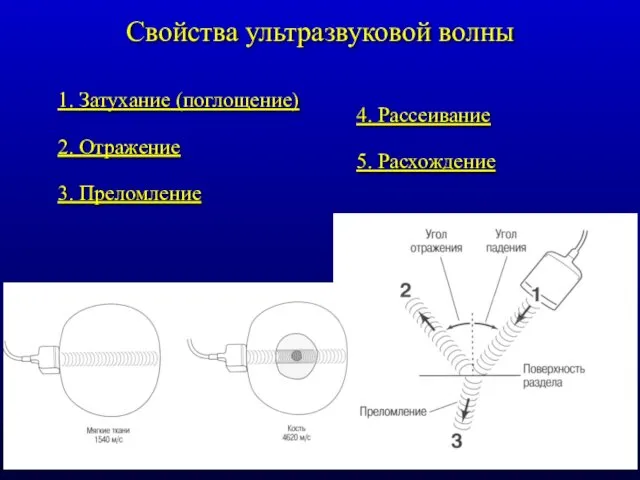 Свойства ультразвуковой волны 1. Затухание (поглощение) 2. Отражение 3. Преломление 4. Рассеивание 5. Расхождение