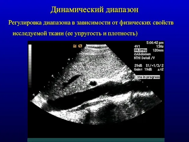 Динамический диапазон Регулировка диапазона в зависимости от физических свойств исследуемой ткани (ее упругость и плотность)