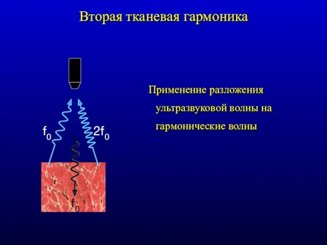 Вторая тканевая гармоника Применение разложения ультразвуковой волны на гармонические волны