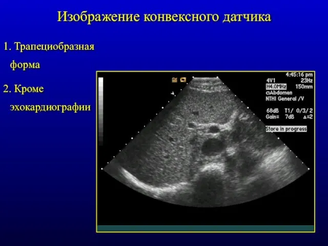Изображение конвексного датчика 1. Трапециобразная форма 2. Кроме эхокардиографии