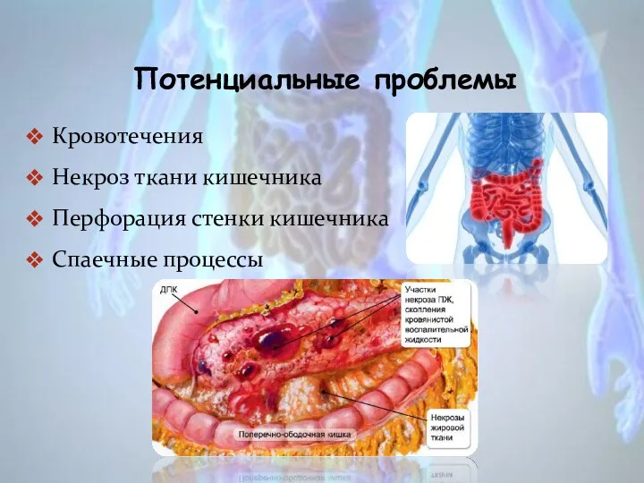 Потенциальные проблемы Кровотечения Некроз ткани кишечника Перфорация стенки кишечника Спаечные процессы