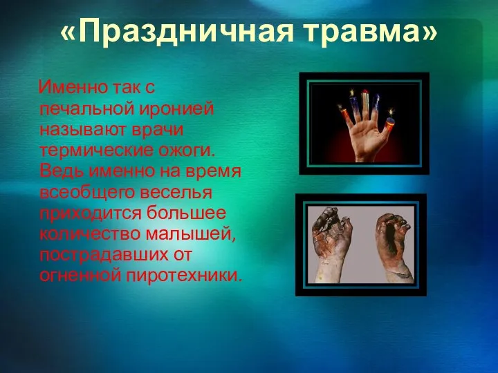 «Праздничная травма» Именно так с печальной иронией называют врачи термические