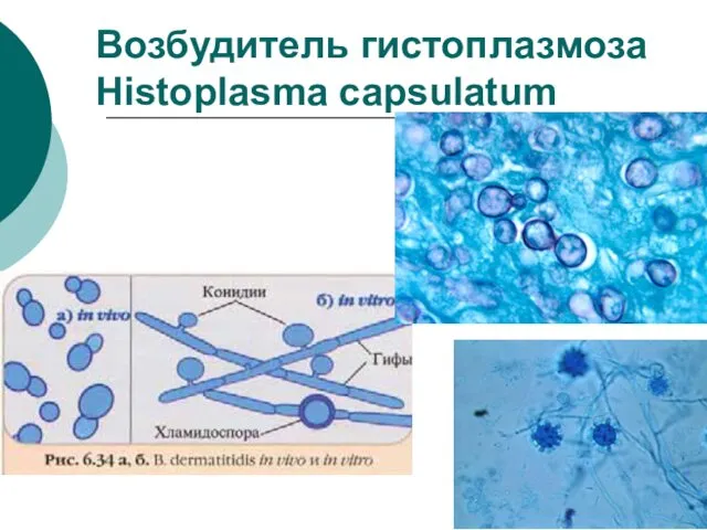 Возбудитель гистоплазмоза Histoplasma capsulatum