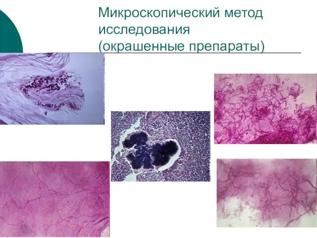 Микроскопический метод исследования (окрашенные препараты)