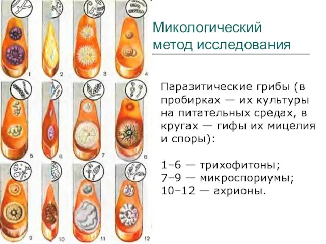 Паразитические грибы (в пробирках — их культуры на питательных средах,