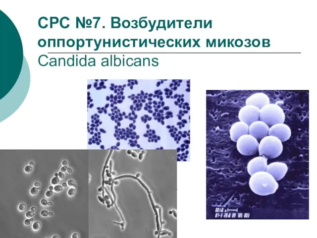 СРС №7. Возбудители оппортунистических микозов Candida albicans