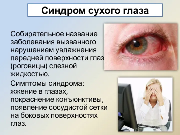 Синдром сухого глаза Собирательное название заболевания вызванного нарушением увлажнения передней