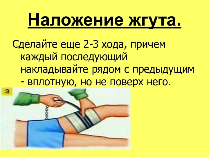 Наложение жгута.