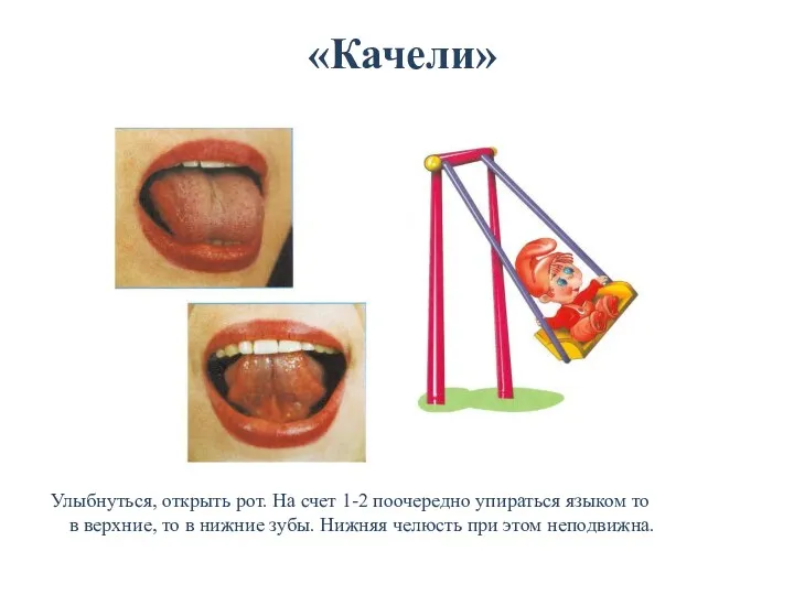 «Качели» Улыбнуться, открыть рот. На счет 1-2 поочередно упираться языком