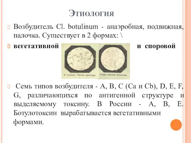 Этиология Возбудитель Cl. botulinum - анаэробная, подвижная, палочка. Существует в