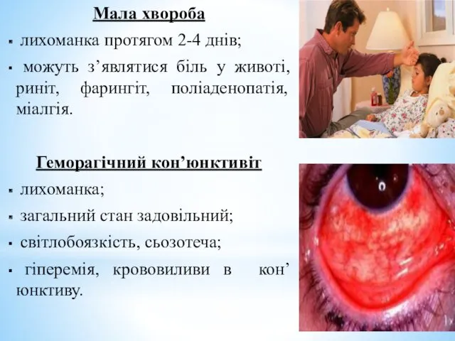 Мала хвороба лихоманка протягом 2-4 днів; можуть з’являтися біль у