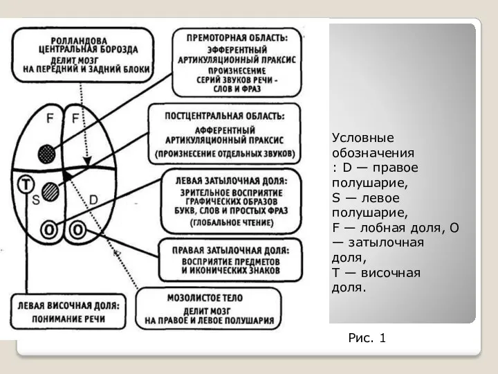 Условные обозначения : D — правое полушарие, S — левое полушарие, F —