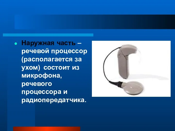 Наружная часть – речевой процессор (располагается за ухом) состоит из микрофона, речевого процессора и радиопередатчика.