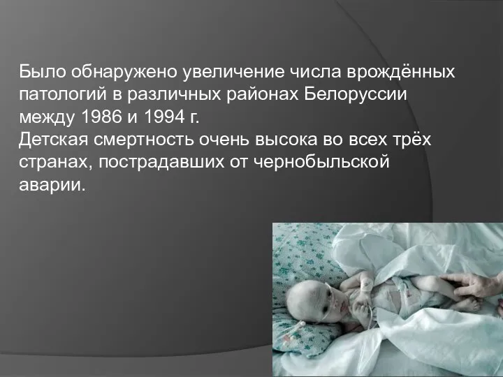 Было обнаружено увеличение числа врождённых патологий в различных районах Белоруссии между 1986 и