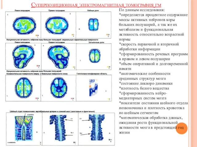 По данным исследования: *определяется процентное содержание массы активных нейронов коры