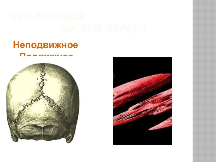 Соединение костей черепа Неподвижное Подвижное