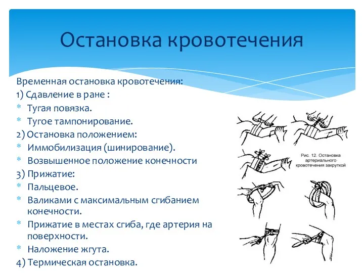 Временная остановка кровотечения: 1) Сдавление в ране : Тугая повязка.