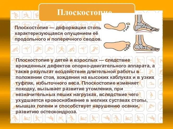 Плоскостопие у детей и взрослых — следствие врожденных дефектов опорно-двигательного