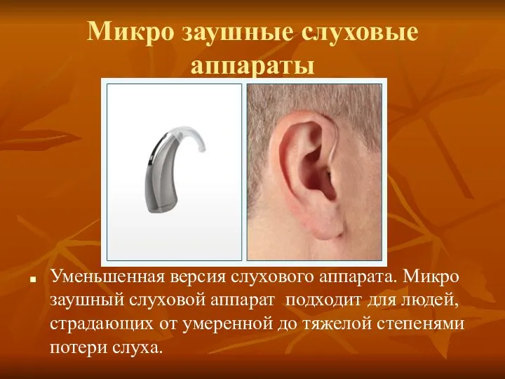 Микро заушные слуховые аппараты Уменьшенная версия слухового аппарата. Микро заушный слуховой аппарат подходит