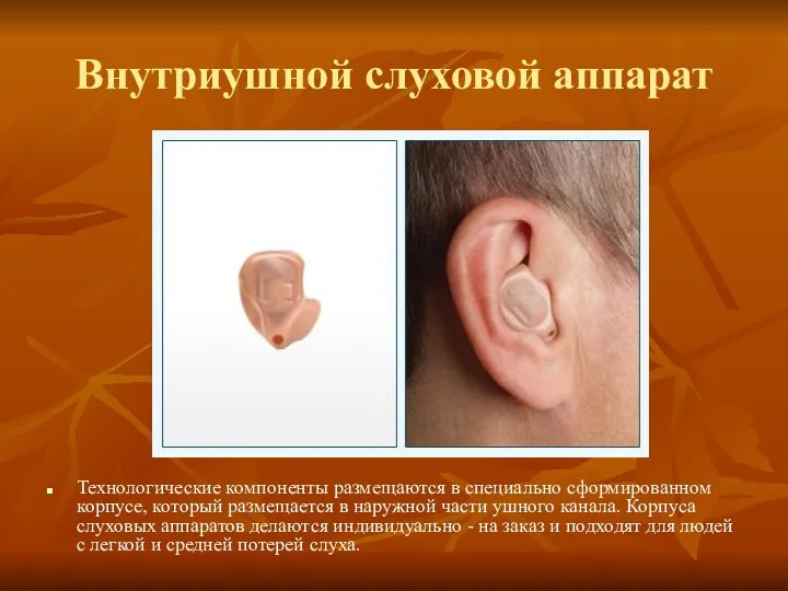 Внутриушной слуховой аппарат Технологические компоненты размещаются в специально сформированном корпусе,
