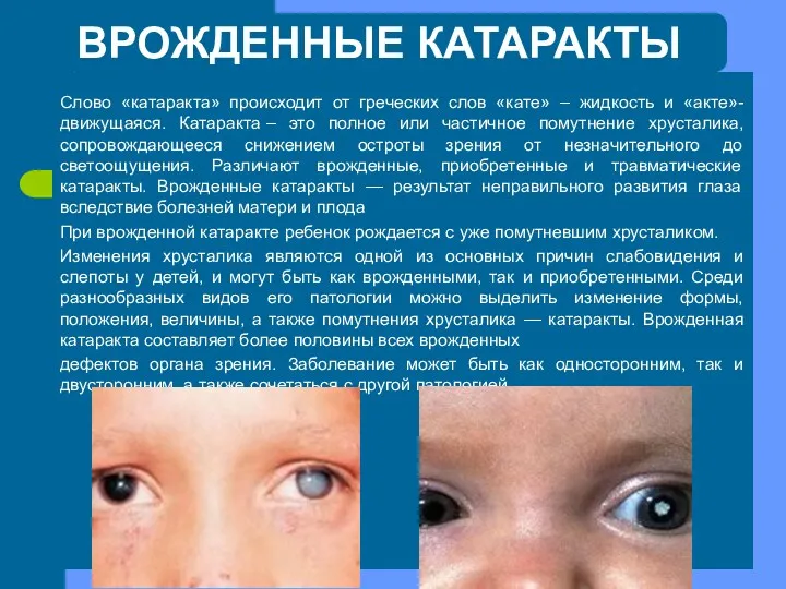 Врожденные катаракты Слово «катаракта» происходит от греческих слов «кате» –