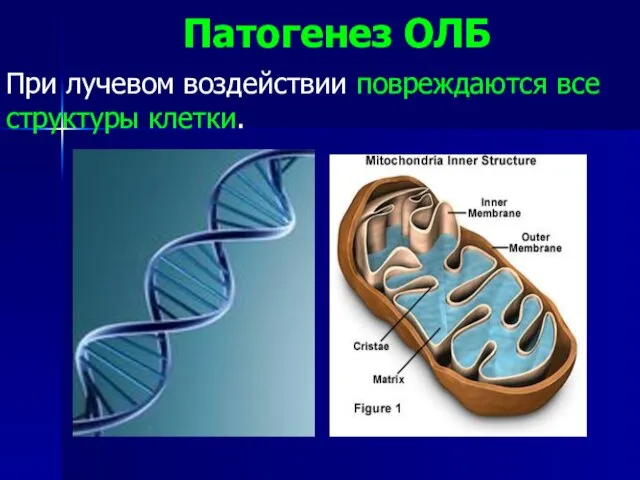 Патогенез ОЛБ При лучевом воздействии повреждаются все структуры клетки.