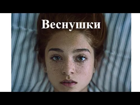 Веснушки