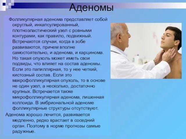 Аденомы Фолликулярная аденома представляет собой округлый, инкапсулированный, плотноэластический узел с