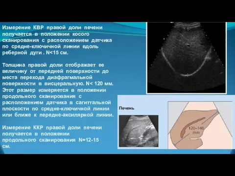 Измерение КВР правой доли печени получается в положении косого сканирования