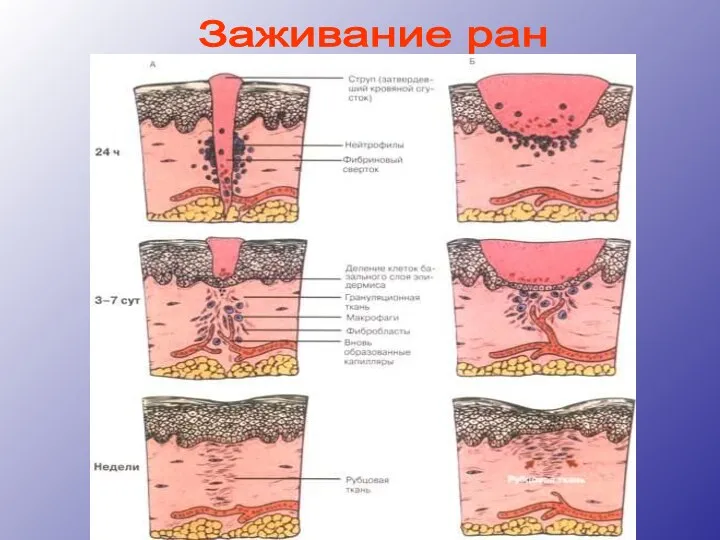 Заживание ран Prezentacii.com