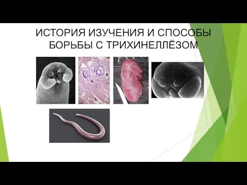 ИСТОРИЯ ИЗУЧЕНИЯ И СПОСОБЫ БОРЬБЫ С ТРИХИНЕЛЛЁЗОМ