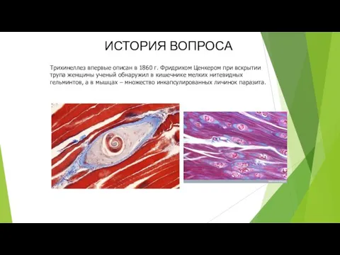 ИСТОРИЯ ВОПРОСА Трихинеллез впервые описан в 1860 г. Фридрихом Ценкером