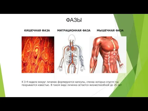 КИШЕЧНАЯ ФАЗА МИГРАЦИОННАЯ ФАЗА МЫШЕЧНАЯ ФАЗА К 3-4 неделе вокруг
