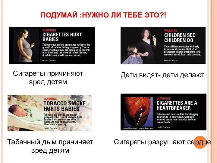 ПОДУМАЙ :НУЖНО ЛИ ТЕБЕ ЭТО?! Сигареты причиняют вред детям Табачный