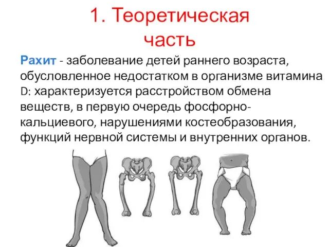 1. Теоретическая часть Рахит - заболевание детей раннего возраста, обусловленное