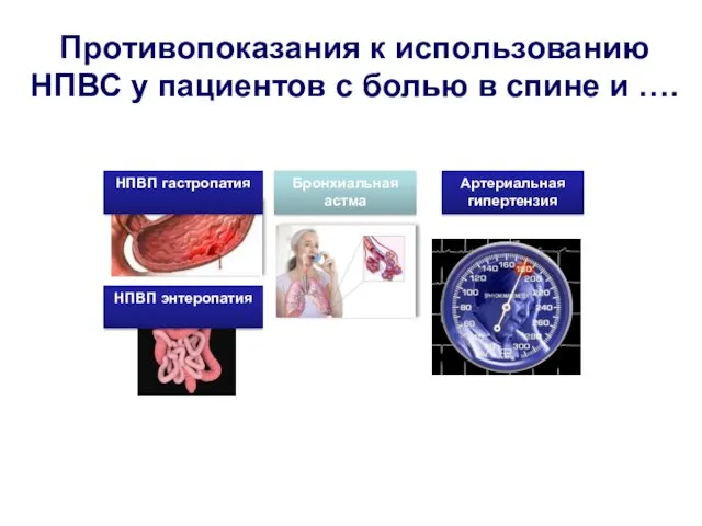 Противопоказания к использованию НПВС у пациентов с болью в спине