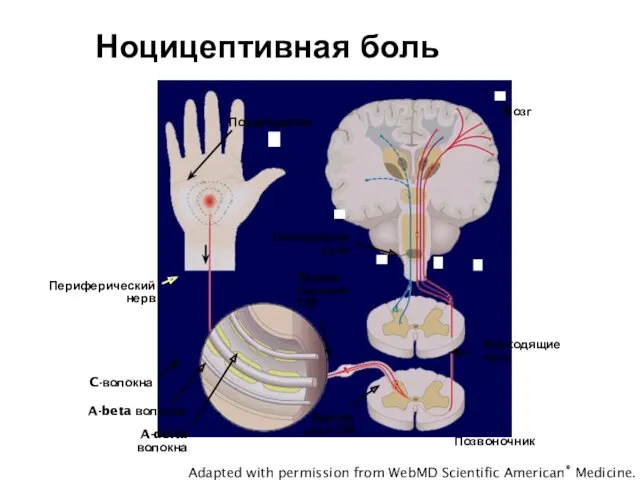 Ноцицептивная боль Повреждение Нисходящие пути Периферический нерв Задние корешки СМ