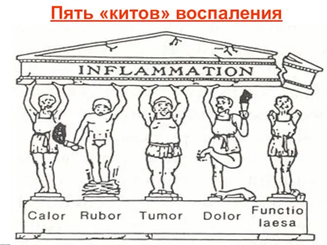 Пять «китов» воспаления