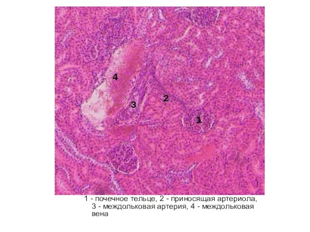 1 - почечное тельце, 2 - приносящая артериола, 3 - междольковая артерия, 4 - междольковая вена