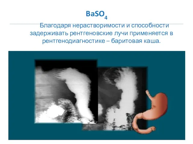 BaSO4 Благодаря нерастворимости и способности задерживать рентгеновские лучи применяется в рентгенодиагностике – баритовая каша.