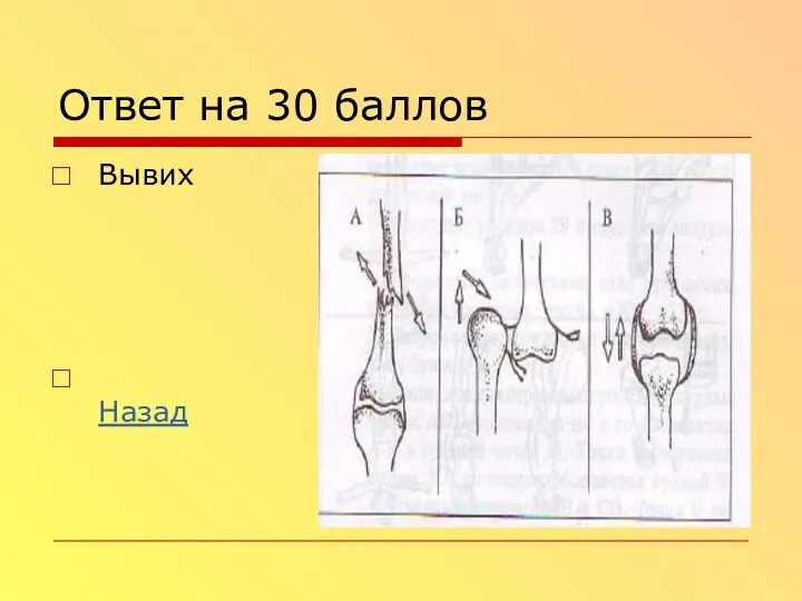 Ответ на 30 баллов Вывих Назад