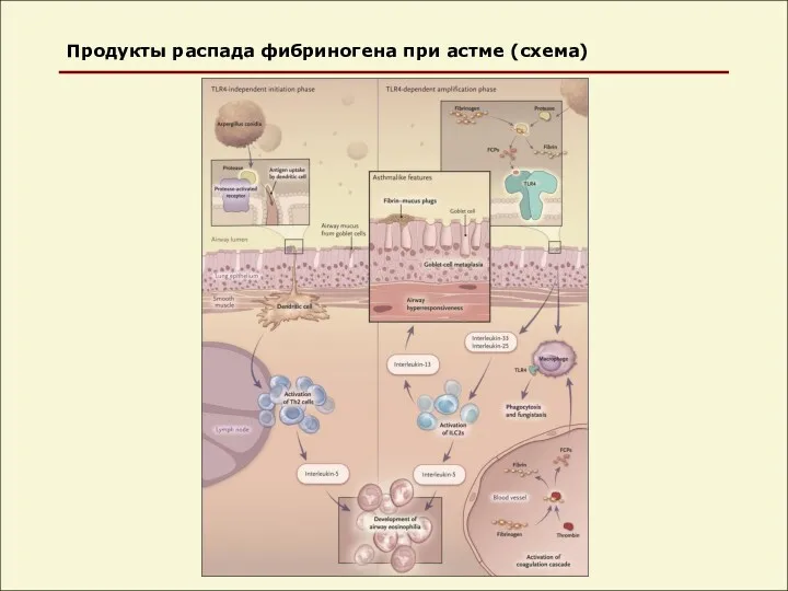 Продукты распада фибриногена при астме (схема)