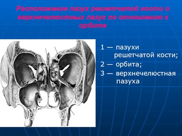 Расположение пазух решетчатой кости и верхнечелюстных пазух по отношению к