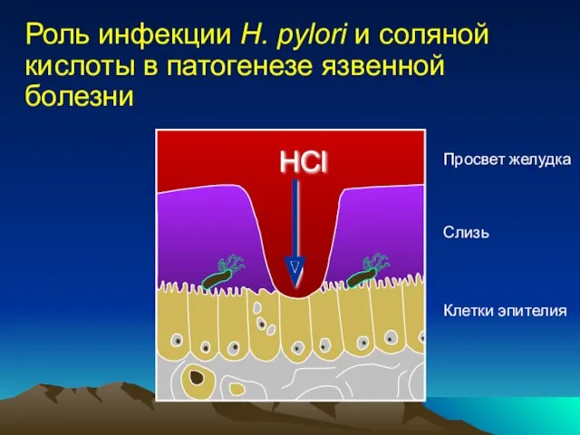 Роль инфекции H. pylori и соляной кислоты в патогенезе язвенной болезни Клетки эпителия
