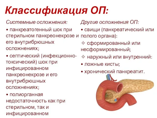 Классификация ОП: Системные осложнения: • панкреатогенный шок при стерильном панкреонекрозе