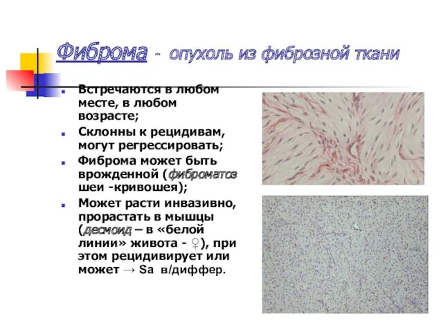 Фиброма - опухоль из фиброзной ткани Встречаются в любом месте,