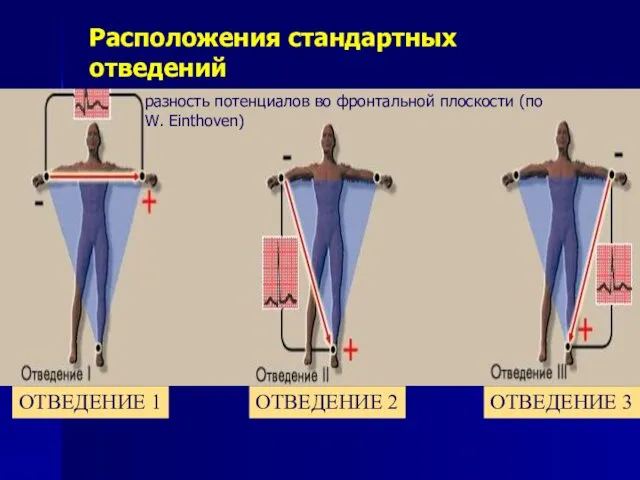 Расположения стандартных отведений ОТВЕДЕНИЕ 1 ОТВЕДЕНИЕ 2 ОТВЕДЕНИЕ 3 разность потенциалов во фронтальной