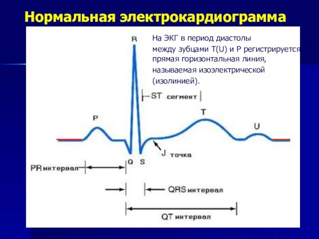 На ЭКГ в период диастолы между зубцами Т(U) и Р